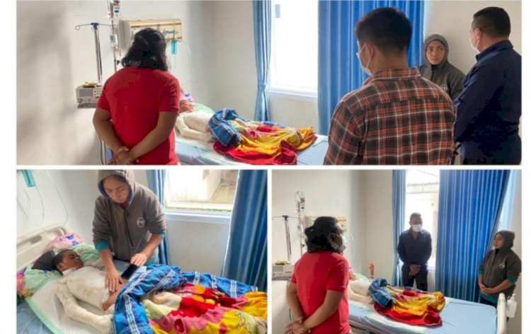 SEORANG ANAK MENGALAMI LUKA BAKAR AKIBAT LEDAKAN MERCON KALENG RAKITAN